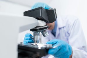 Does Medicare Cover Alexander Disease